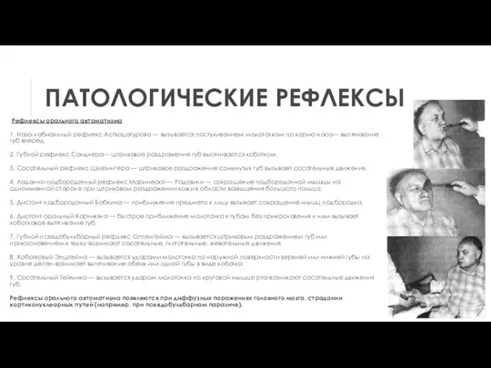 ПАТОЛОГИЧЕСКИЕ РЕФЛЕКСЫ Рефлексы орального автоматизма 1. Назо-лабиальный рефлекс Аствацатурова — вызывается постукиванием