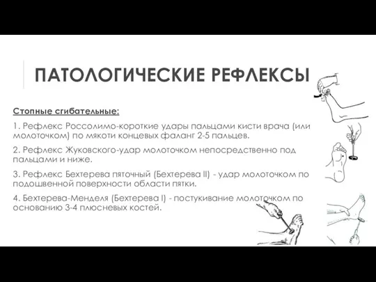 ПАТОЛОГИЧЕСКИЕ РЕФЛЕКСЫ Стопные сгибательные: 1. Рефлекс Россолимо-короткие удары пальцами кисти врача (или