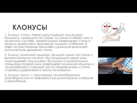 КЛОНУСЫ 1. Клонус стопы. Левую руку подводят под колено больного, лежащего на