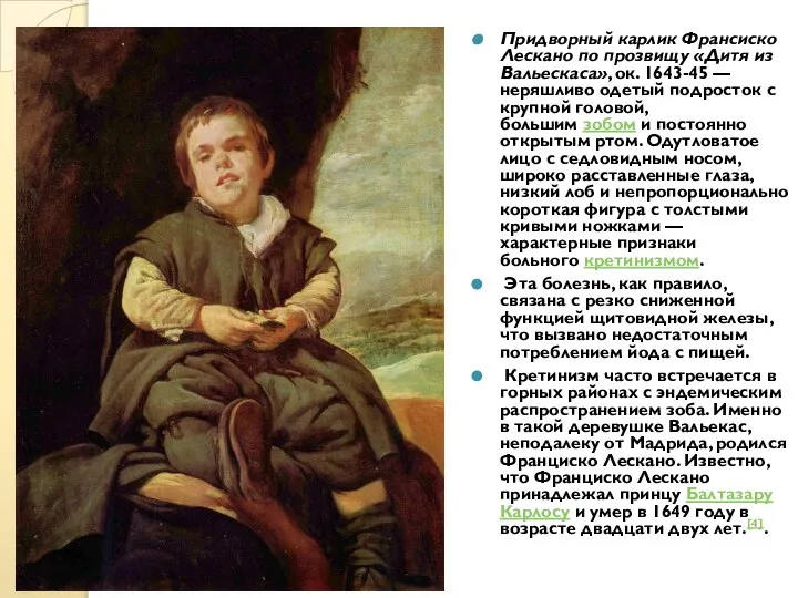 Придворный карлик Франсиско Лескано по прозвищу «Дитя из Вальескаса», ок. 1643-45 —