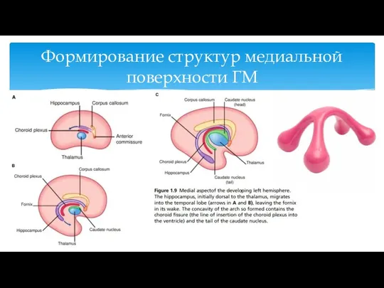 Формирование структур медиальной поверхности ГМ