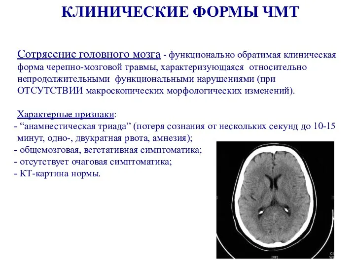 КЛИНИЧЕСКИЕ ФОРМЫ ЧМТ Сотрясение головного мозга - функционально обратимая клиническая форма черепно-мозговой