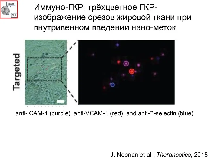 anti-ICAM-1 (purple), anti-VCAM-1 (red), and anti-P-selectin (blue) Иммуно-ГКР: трёхцветное ГКР-изображение срезов жировой