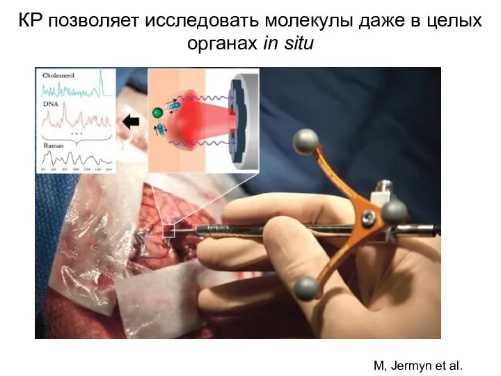 M, Jermyn et al. 2015 КР позволяет исследовать молекулы даже в целых органах in situ