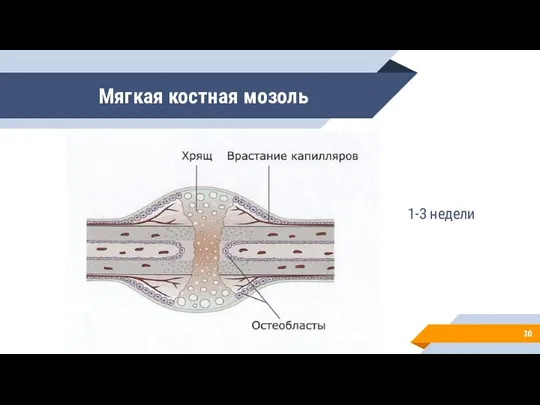 Мягкая костная мозоль 1-3 недели