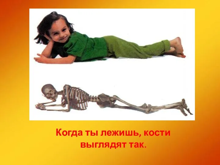 Когда ты лежишь, кости выглядят так.