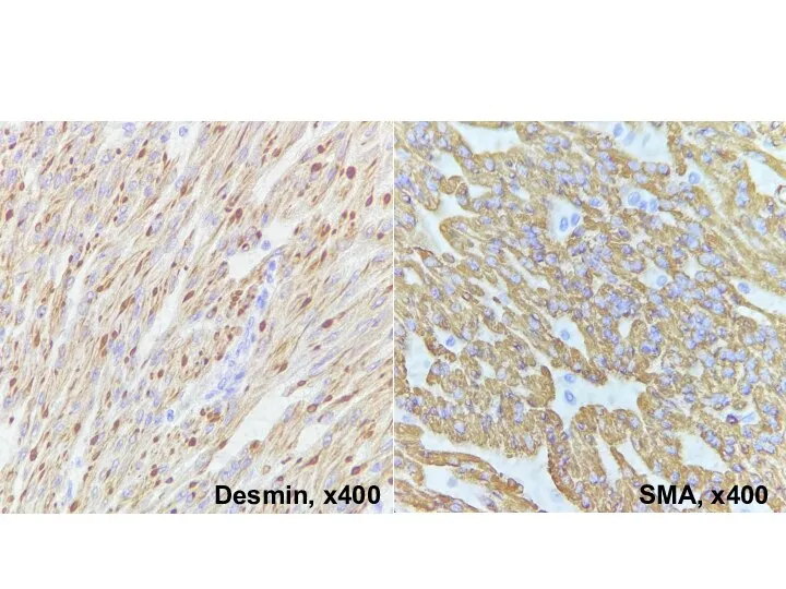 Desmin, х400 SMA, х400