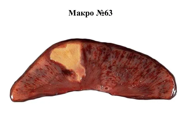 Макро №63