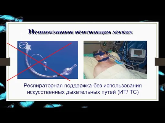 Неинвазивная вентиляция легких Респираторная поддержка без использования искусственных дыхательных путей (ИТ/ ТС)