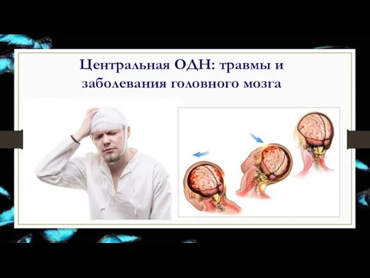 Центральная ОДН: травмы и заболевания головного мозга