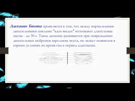 Дыхание Биота проявляется в том, что между нормальными дыхательными циклами "вдох-выдох" возникают