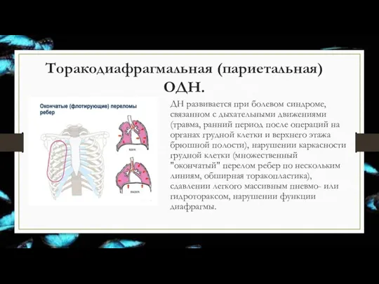 Торакодиафрагмальная (париетальная) ОДН. ДН развивается при болевом синдроме, связанном с дыхательными движениями