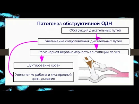 Патогенез обструктивной ОДН Обструкция дыхательных путей Увеличение сопротивления дыхательных путей Регионарная неравномерность