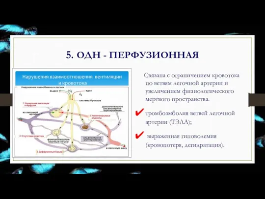 5. ОДН - ПЕРФУЗИОННАЯ Связана с ограничением кровотока по ветвям легочной артерии