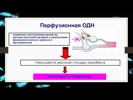 Перфузионная ОДН снижение поступления крови по ветвям легочной артерии и увеличение физиологического