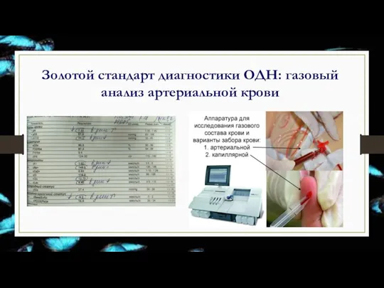 Золотой стандарт диагностики ОДН: газовый анализ артериальной крови