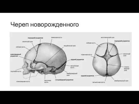 Череп новорожденного