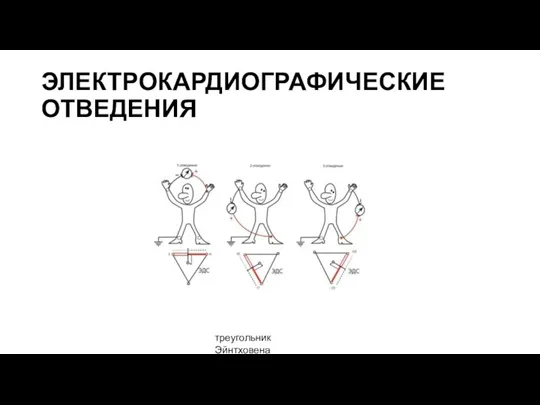 ЭЛЕКТРОКАРДИОГРАФИЧЕСКИЕ ОТВЕДЕНИЯ треугольник Эйнтховена