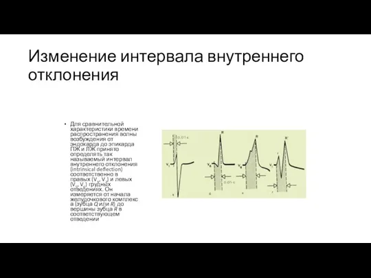 Изменение интервала внутреннего отклонения Для сравнительной характеристики времени распространения волны возбуждения от