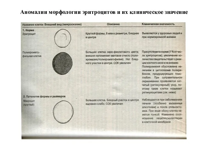 Аномалии морфологии эритроцитов и их клиническое значение