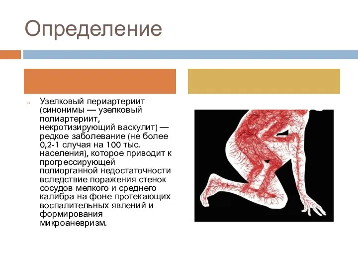 Определение Узелковый периартериит (синонимы — узелковый полиартериит, некротизирующий васкулит) — редкое заболевание