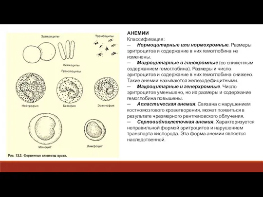 АНЕМИИ Классификация: ─ Нормоцитарные или нормохромные. Размеры эритроцитов и содержание в них