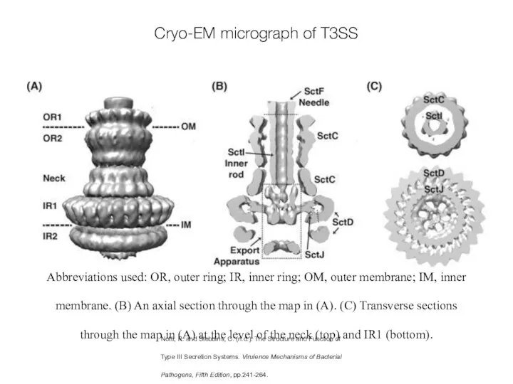 Cryo-EM micrograph of T3SS Abbreviations used: OR, outer ring; IR, inner ring;