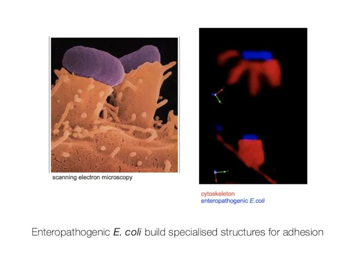 Enteropathogenic E. coli build specialised structures for adhesion