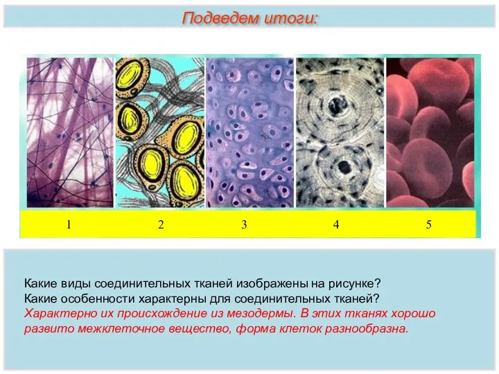 Подведем итоги: Какие виды соединительных тканей изображены на рисунке? Какие особенности характерны