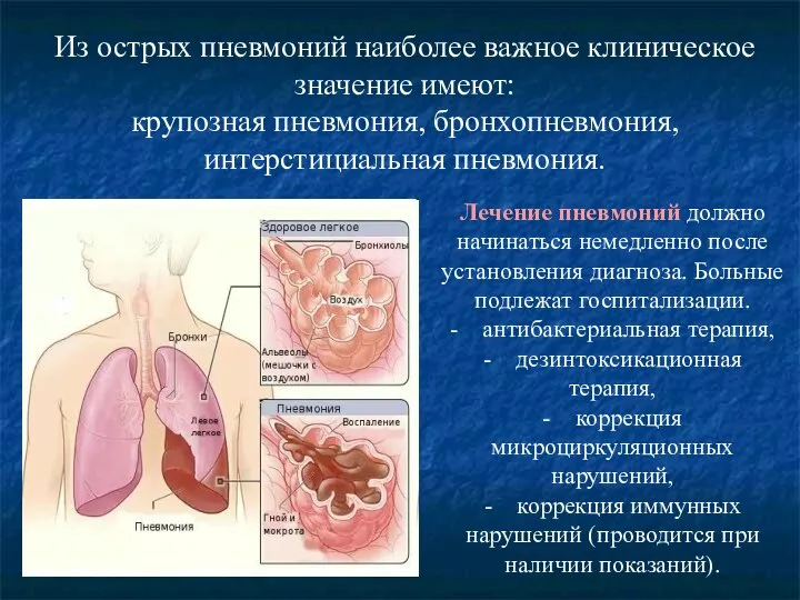 Из острых пневмоний наиболее важное клиническое значение имеют: крупозная пневмония, бронхопневмония, интерстициальная