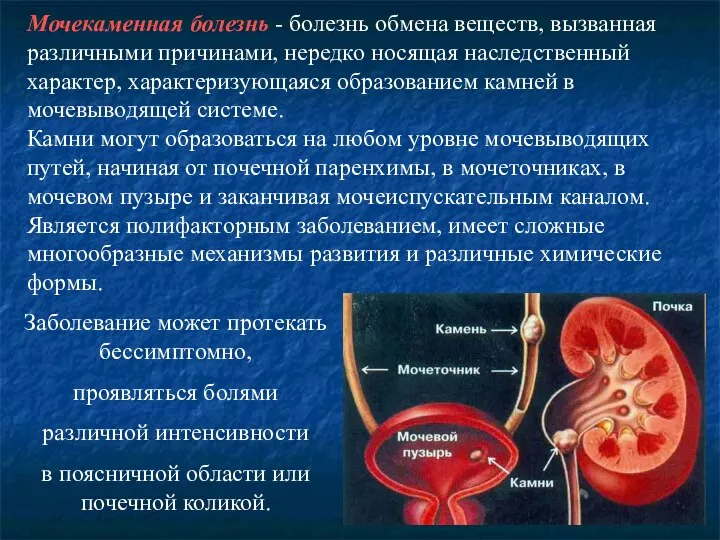 Мочекаменная болезнь - болезнь обмена веществ, вызванная различными причинами, нередко носящая наследственный