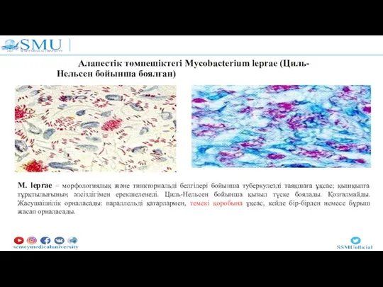 Алапестік төмпешіктегі Mycobacterium leprae (Циль-Нельсен бойынша боялған) M. leprae – морфологиялық және