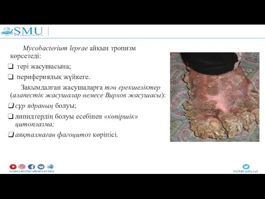 Mycobacterium leprae айқын тропизм көрсетеді: тері жасушасына; перифериялық жүйкеге. Зақымдалған жасушаларға тән