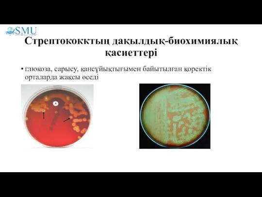 Стрептококктың дақылдық-биохимиялық қасиеттері глюкоза, сарысу, қансұйықтығымен байытылған қоректік орталарда жақсы өседі