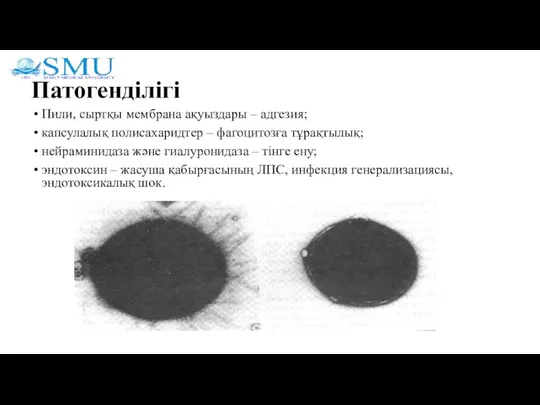 Патогенділігі Пили, сыртқы мембрана ақуыздары – адгезия; капсулалық полисахаридтер – фагоцитозға тұрақтылық;