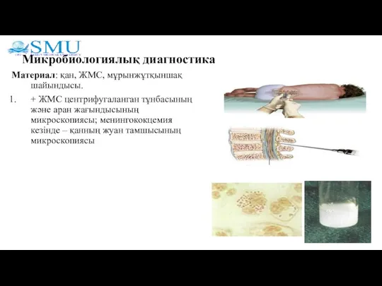 Микробиологиялық диагностика Материал: қан, ЖМС, мұрынжұтқыншақ шайындысы. + ЖМС центрифугаланган тұнбасының және