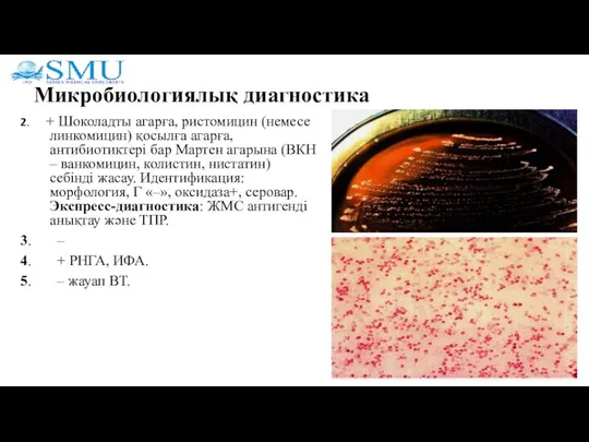 Микробиологиялық диагностика 2. + Шоколадты агарға, ристомицин (немесе линкомицин) қосылға агарға, антибиотиктері