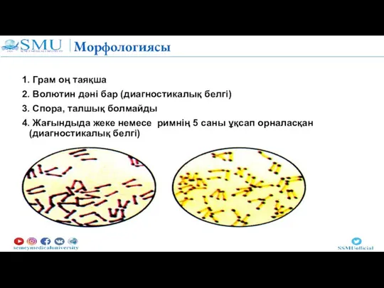 Морфологиясы 1. Грам оң таяқша 2. Волютин дәні бар (диагностикалық белгі) 3.