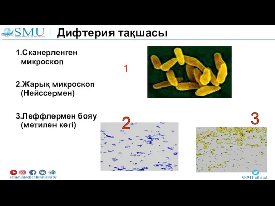 Дифтерия тақшасы 1.Сканерленген микроскоп 2.Жарық микроскоп (Нейссермен) 3.Леффлермен бояу (метилен көгі) 2 3 1