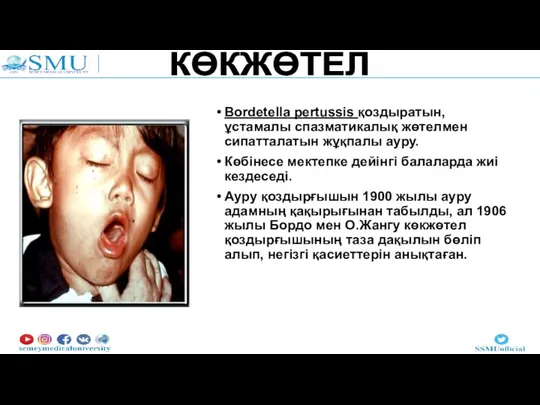 Bordetella pertussis қоздыратын, ұстамалы спазматикалық жөтелмен сипатталатын жұқпалы ауру. Көбінесе мектепке дейінгі