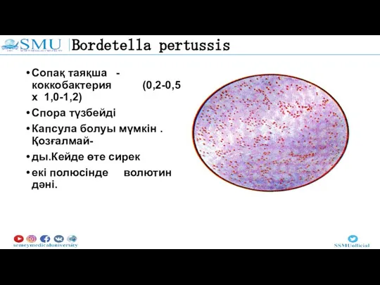 Bordetella pertussis Сопақ таяқша - коккобактерия (0,2-0,5 х 1,0-1,2) Спора түзбейді Капсула