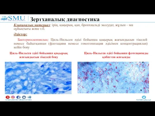 Зертханалық диагностика Клиникалық материал: ірің, қақырық, қан, бронхиальді экссудат, жұлын – ми