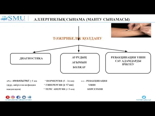 АЛЛЕРГИЯЛЫҚ СЫНАМА (МАНТУ СЫНАМАСЫ) ТӘЖІРИБЕЛІК ҚОЛДАНУ ДИАГНОСТИКА АУРУДЫҢ АҒЫМЫН БОЛЖАУ РЕВАКЦИНАЦИЯ ҮШІН