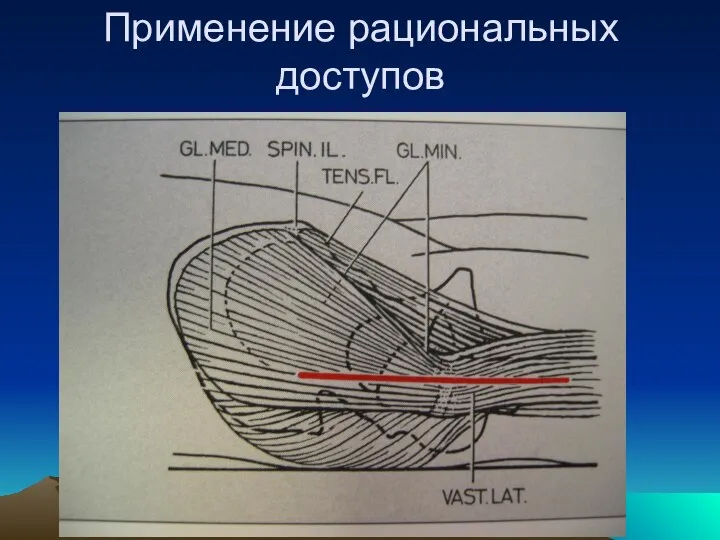 Применение рациональных доступов