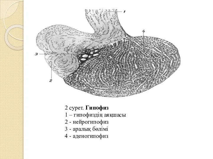 2 сурет. Гипофиз 1 – гипофиздің аяқшасы 2 - нейрогипофиз 3 -