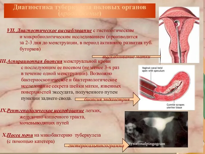 VII. Диагностическое выскабливание с гистологическим и микробиологическим исследованием (производится за 2-3 дня