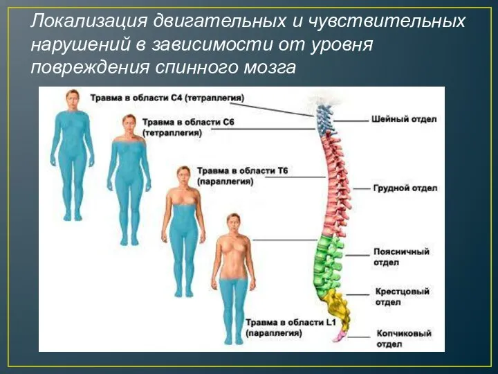 Локализация двигательных и чувствительных нарушений в зависимости от уровня повреждения спинного мозга