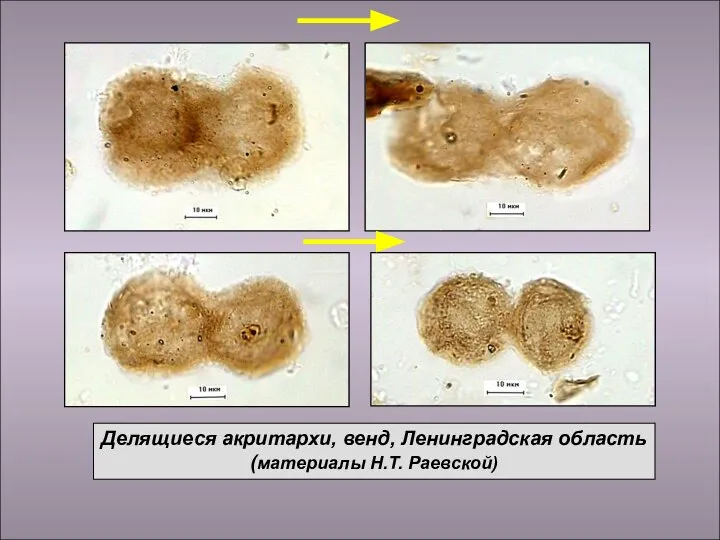 Делящиеся акритархи, венд, Ленинградская область (материалы Н.Т. Раевской)