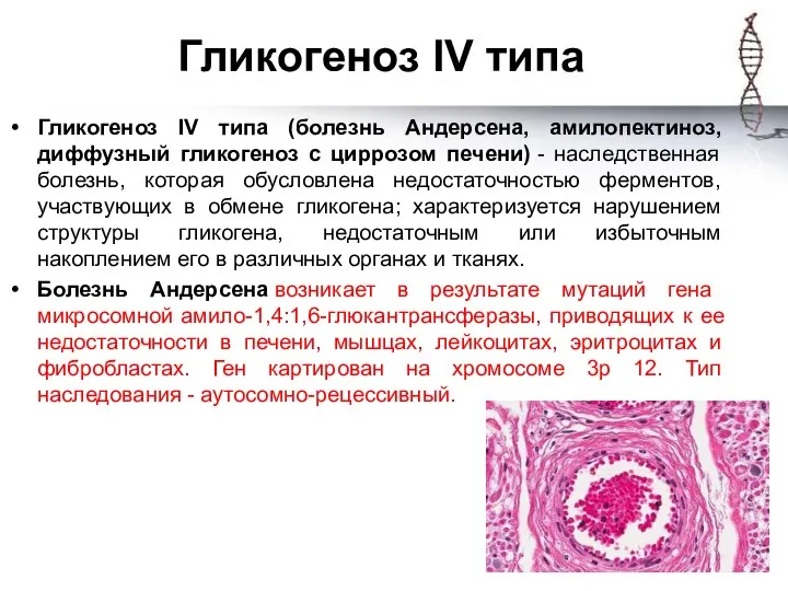 Гликогеноз IV типа Гликогеноз IV типа (болезнь Андерсена, амилопектиноз, диффузный гликогеноз с