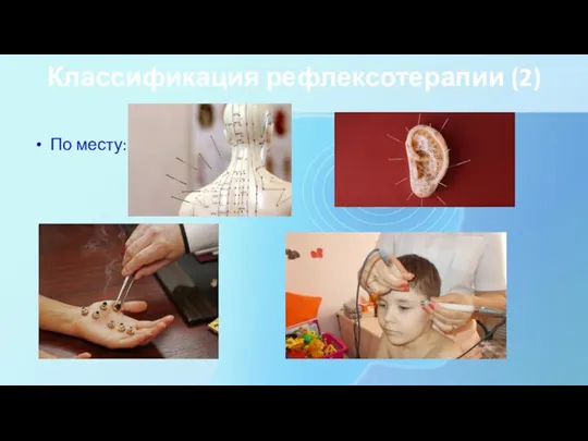 Классификация рефлексотерапии (2) По месту: